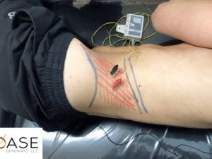 Chronic Low Back Pain Assessment & Treatment